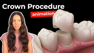 Dental Crown Procedure at the Dentist [upl. by Bonilla]