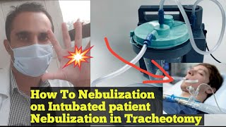 Nebulization on ventilator  how to give nebulization via tracheostomy  How to Nebulize ETT [upl. by Cappello]