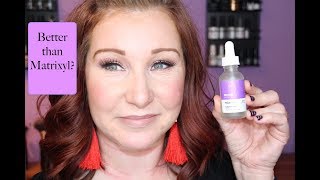 Hylamide Sub Q AntiAge Serum Review [upl. by Reema]