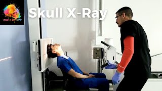 XRay Positioning  Skull SMV view ☢️ YourXRayTech [upl. by Aronson]