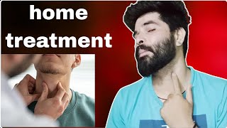 Adams apple ko ander kaise kare  home treatment [upl. by Nairrad238]