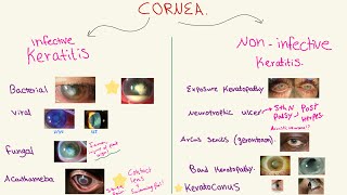 Disorders of the CORNEA  شرح الرمد [upl. by Bracci]