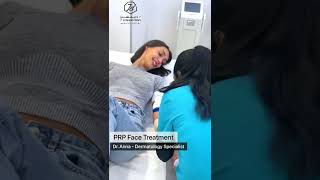 PRP Face Treatment [upl. by Ahsinev]