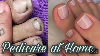 Feet Whitening Pedicure  Time Saving Feet Whitening Pedicure In Budget [upl. by Aiel]