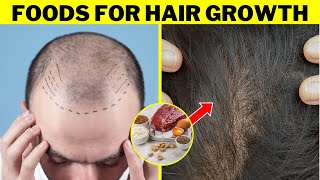 8 BEST Foods To Boost Your Hair Growth [upl. by Wetzell]