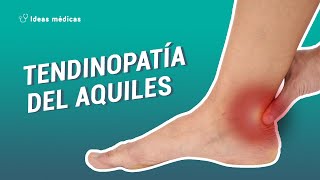 TENDINOPATÍA DEL AQUILES TENDINITIS AQUILIANA O AQUÍLEA QUÉ ES DIAGNÓSTICO TRATAMIENTO [upl. by Etnovaj]