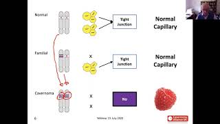 An Introduction to Cavernoma Genetics with David White Science of Cavernoma Series [upl. by Blasien194]