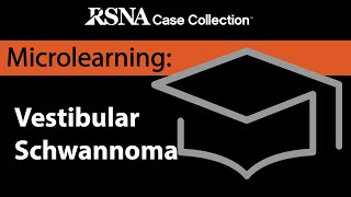 Microlearning Curriculum Series Vestibular Schwannoma [upl. by Peppie]