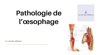 Pathologie de l’œsophage [upl. by Candace]