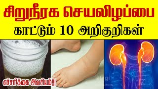 சிறுநீரக செயலிழப்பு அறிகுறிகள்  Top 10 Symptoms of kidney failure  signs of kidney failure Tamil [upl. by Keifer563]