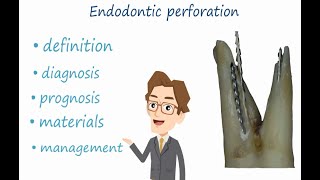 The Ultimate Guide to Endodontic Perforation Management What every dentist must know [upl. by Curley]