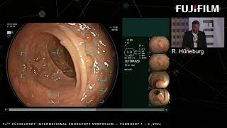 Fujifilm Healthcare Satellite Symposium at the 26th Düsseldorf International Endoscopy Symposium [upl. by Dawes]