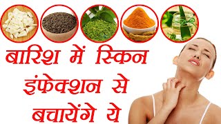 Skin Care in Monsoon  Home Remedies  बारिश में स्किन इंफेक्शन के लिए घरेलू उपचार  BoldSky [upl. by Mallon]