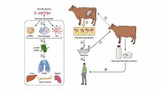 Brucellosis [upl. by Aihsit]