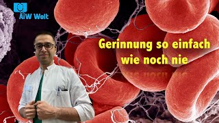 Die praktische Gerinnung so einfach wie noch nie [upl. by Yllut]