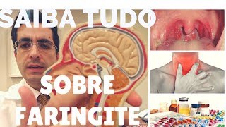 FARINGITE O QUE É  QUAIS SÃO AS CAUSAS E COMO PREVENIR Dr Paulo Mendes Jr Otorrino em Curitiba [upl. by Marga]