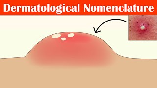 Describing Skin Lesions Dermatological Nomenclature  Macule Papule Pustule Vesicle amp Others [upl. by Prichard]