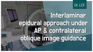 TrailerLearn contralateral oblique Carm image anatomy for lumbar interlaminar epidural block [upl. by Mir510]