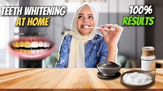 Teeth Whitening At Home  Guaranteed Results  No More Yellow Teeth  Dietitian Aqsa [upl. by Hervey]