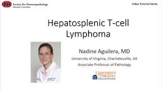 Hepatosplenic Tcell lymphoma [upl. by Aufmann]