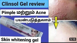 clinsol Gel review in Tamil Best cream for pimples and acne best skin whitening cream [upl. by Mcnelly461]