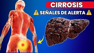 11 Señales Tempranas de Cirrosis Hepática que No Debes Ignorar [upl. by Donata]