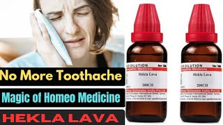 Instant relief from Severe Toothache Homeopathic medicine Hekla Lava  How to Use Details in Hindi [upl. by Neevan263]