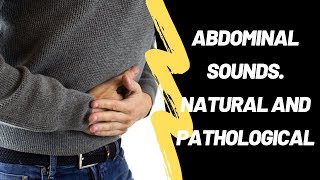 Abdominal Sounds Natural And Pathological [upl. by Ennad]