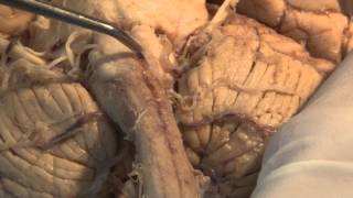 The Most Important Pathway Motor Control Neuroanatomy Video Lab  Brain Dissections [upl. by Otilopih216]