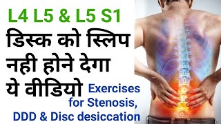 exercises for back pain Disc Dessication stenosis l4l5 l5s1 facet joint by dr sandeep Bhardwaj [upl. by Gemina]