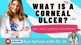 What Is A Corneal Ulcer  Types Causes Symptoms and Treatments [upl. by Lemart]