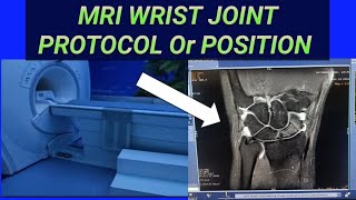 MRI WRIST JOINT PROTOCOL OR POSITION Mri wrist joint sequences or patient positioning [upl. by Maurene]