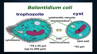 Balantidium coli [upl. by Yeslaehc900]