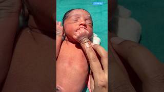 Newborn Very Hungry medical viralvideo [upl. by Elbas]