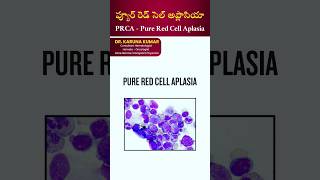 PRCA  Pure Red Cell Aplasia ప్యూర్ రెడ్ సెల్ అప్లాసియా prca PureRedCellAplasia hemoglobin [upl. by Sikorski]