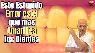 🆘 ESTE ESTUPIDO ERROR ES EL QUE MAS PONE LOS DIENTES AMARILLOS 🆘 [upl. by Merrill]