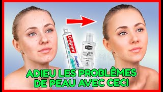 vaseline plus dentifrice pour soigner les problèmes de peau [upl. by Siroved]