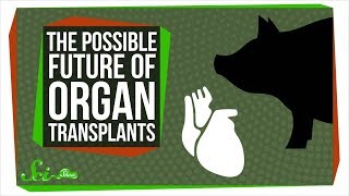 Bioprinting and Pig Chimeras The Possible Future of Organ Transplants [upl. by Meghann]