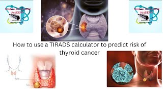 How to use the TIRADS calculator to predict the risk of thyroid nodule cancer or malignancy [upl. by Harms]