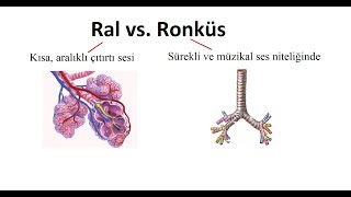 Ral vs Ronküs Patolojik Solunum Sesleri [upl. by Beaver574]