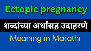 Ectopic pregnancy Meaning In Marathi  Ectopic pregnancy explained in Marathi [upl. by Aihsitan63]