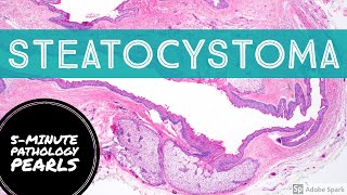 Steatocystoma 5Minute Pathology Pearls [upl. by Brost]