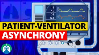 PatientVentilator Asynchrony Medical Definition  Quick Explainer Video [upl. by Bibbye]