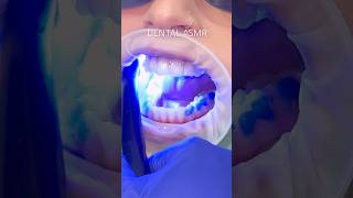 Dental ASMR Invisalign fit appointment 🙌 asmr asmrsounds invisalign asmrvideo viral [upl. by Amand]