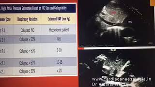 Transthoracic Echocardiography [upl. by Luann]