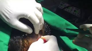 Biopsy for type of alopecia [upl. by Parthinia]