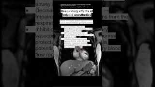 Respiratory effects of volatile anesthetics [upl. by Knight227]