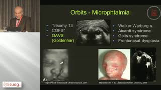 craniofacial anomalies [upl. by Raval]