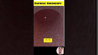 capsule endoscopy 3d animation ।medical shorts doctor ytshorts viral [upl. by Kizzee]