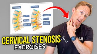 5 Exercises for Cervical Stenosis Arm Nerve Pain [upl. by Uhile]